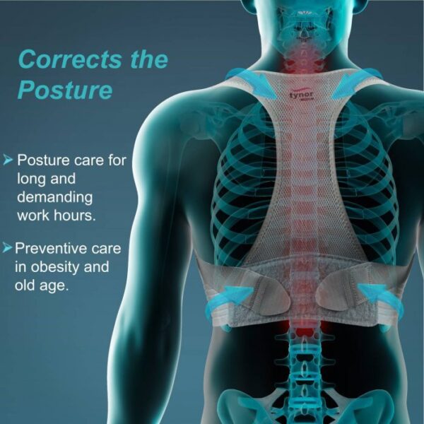 Posture Corrector For Neck Hump 700x700 1